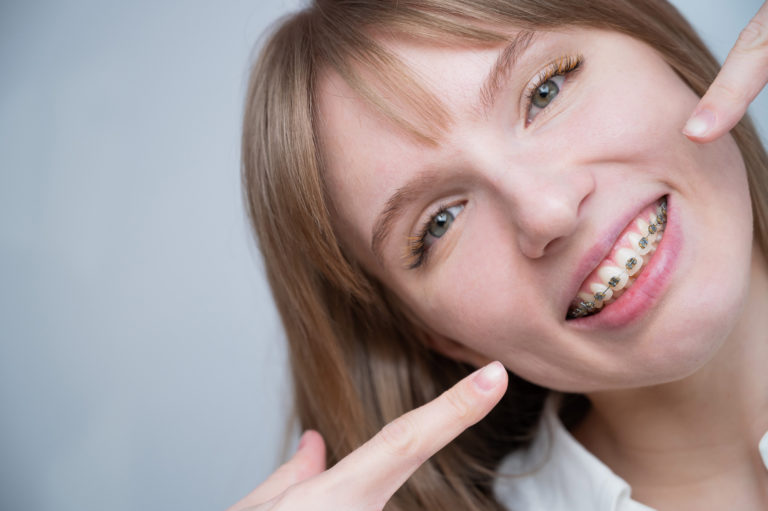 5 Key Benefits of Dental Braces and Invisalign (Including a Great Smile)