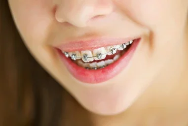 Home - portrait cute kid dental braces 260nw 486599746 e1751477798368